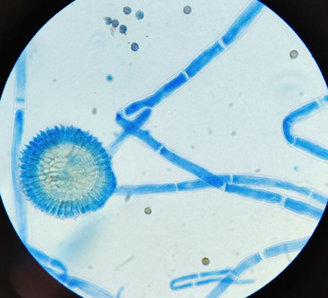 Rise of Climate-Driven Fungal Diseases