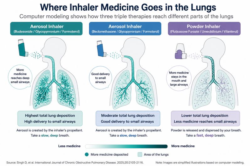 Aerosol or Powder? Why the Type of Inhaler Can Change Where Asthma and COPD Medicine Goes