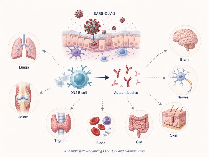 How COVID-19 May Nudge the Immune System Toward Autoimmunity
